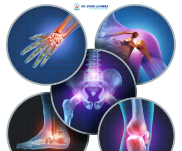 Comprehensive Guide to Arthritis Treatment by Dr Vivek Loomba