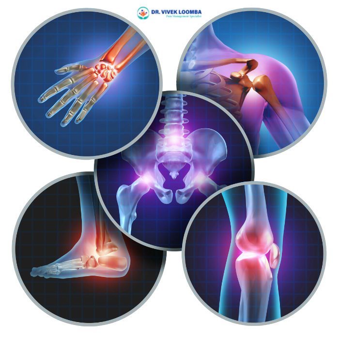 Comprehensive Guide to Arthritis Treatment by Dr Vivek Loomba