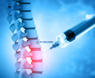 Steroids for Back Pain Effective Relief or Temporary Fix A Comprehensive Guide